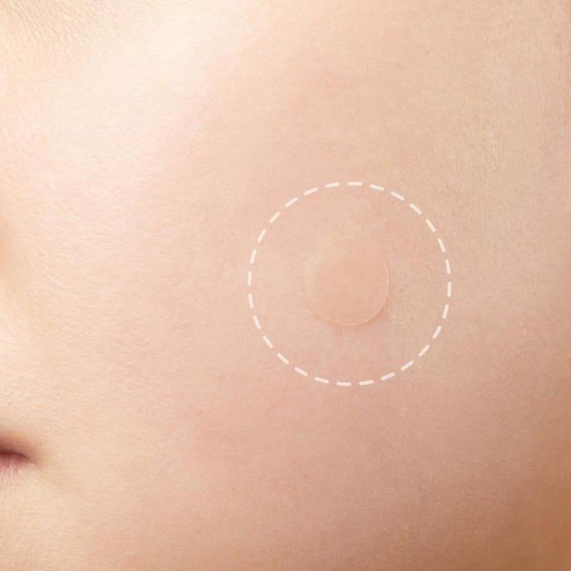 맞춤형 여드름 패치, 방수성, 눈에 띄지 않고 적용하기 쉬운 메이크업, 소스 제조업체, 여드름 패치, OEM 가공