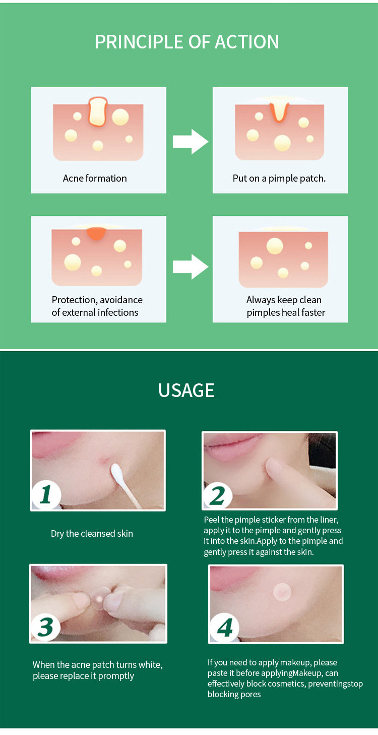 맞춤형 여드름 패치, 방수성, 눈에 띄지 않고 적용하기 쉬운 메이크업, 소스 제조업체, 여드름 패치, OEM 가공